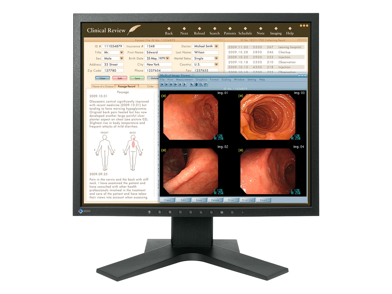 Eizo RadiForce MX192: 19