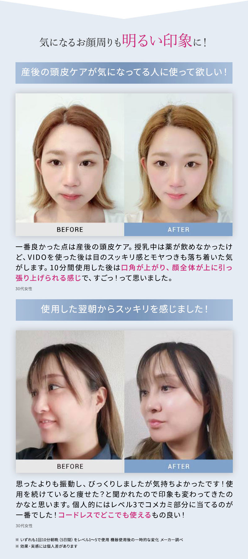 正規品販売店】MYTREX VIDO マイトレックス ヘッドマッサージャー