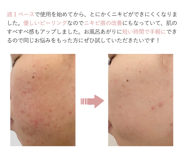 PICK UPアイテム | アイテム【エステサロンKAREN（カレン）】