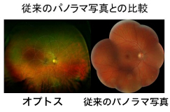 多焦点眼内レンズ、厚生労働省先進医療認定施設の【医療法人社団 大橋