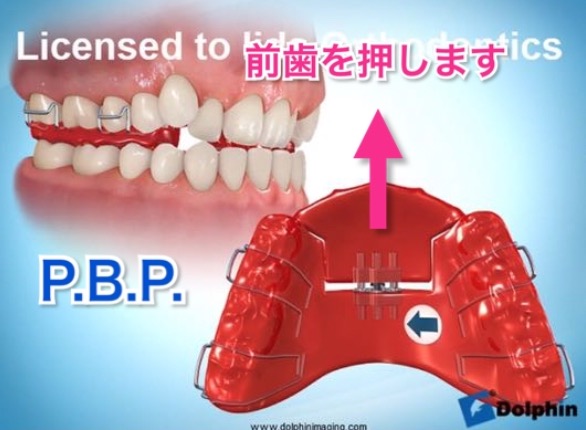 P.B.P. | 南千住の矯正歯科【南千住小児歯科矯正歯科】土日診療