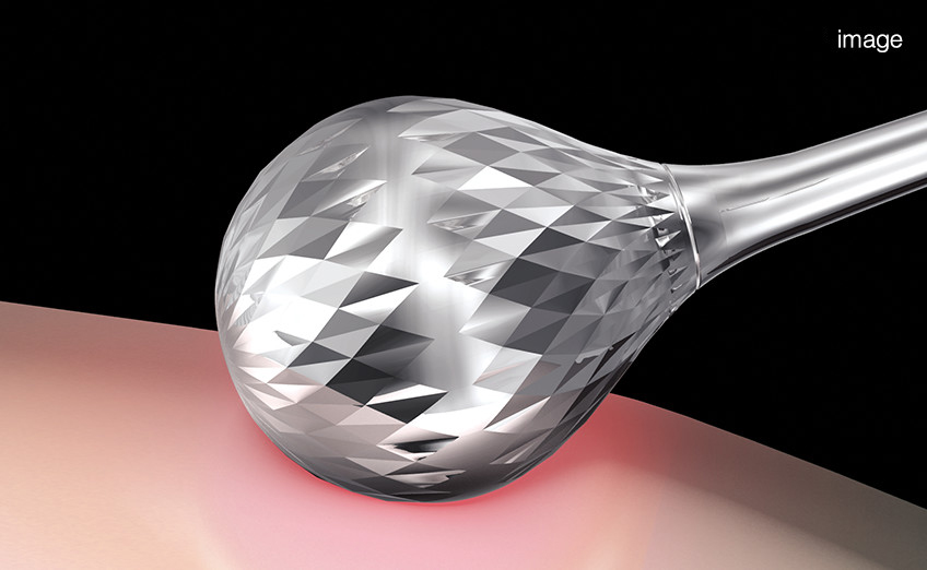 ReFa O STYLE | PRODUCTS | ReFa | MTG Co., Ltd.