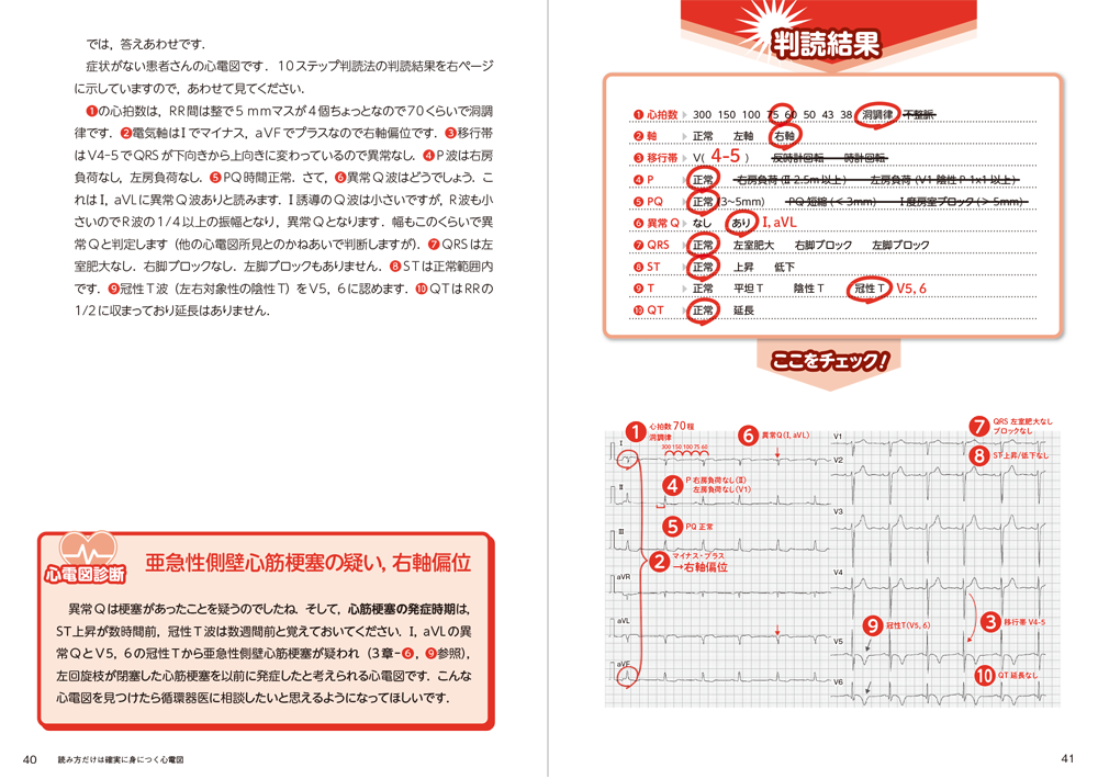 読み方だけは確実に身につく心電図 - 羊土社