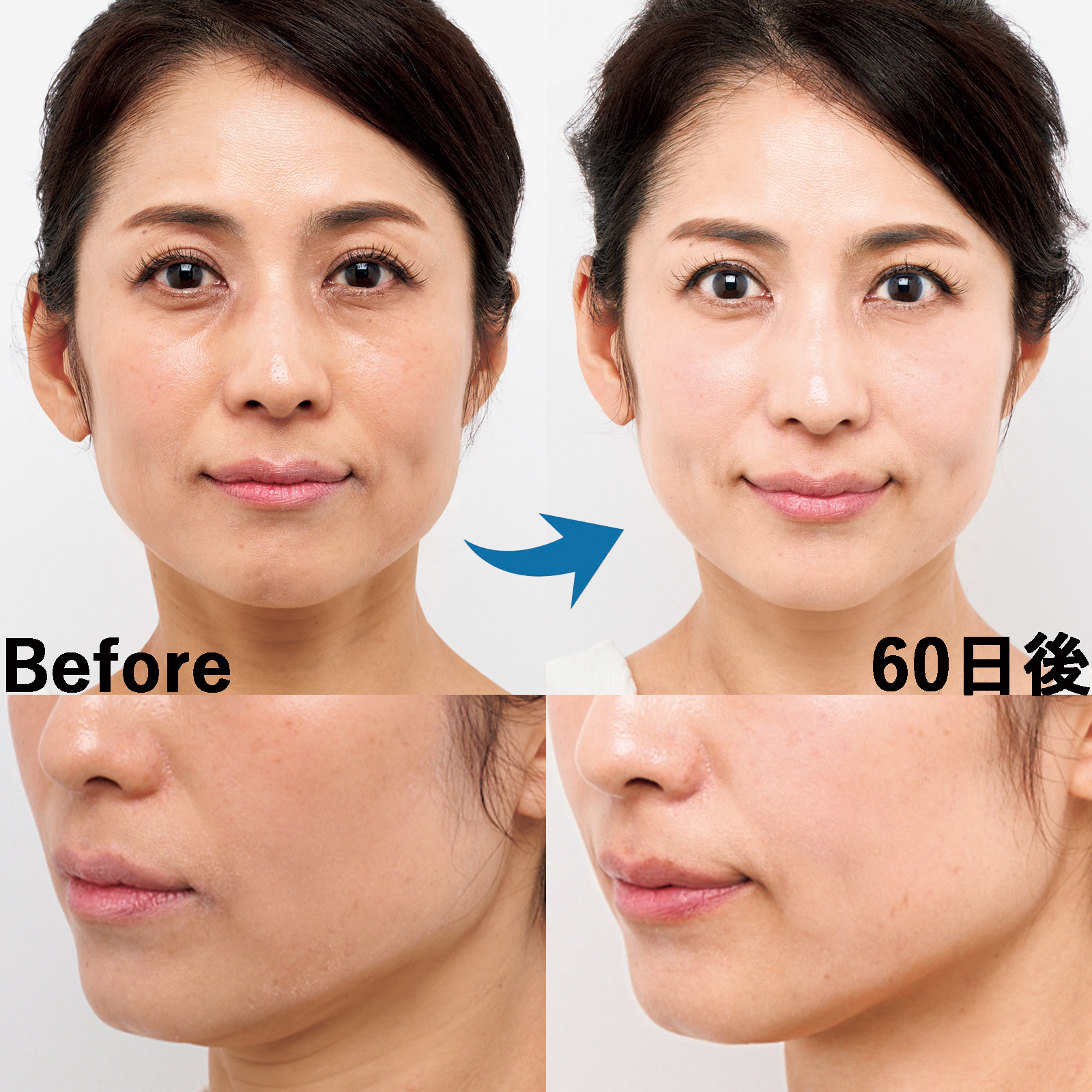 迷ったら「ReFa」で本当にいい？ 美顔器を60日ガチで使い続けた結果が