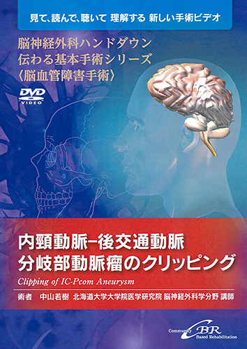 脳神経外科ハンドダウン伝わる基本手術シリーズ〈脳血管障害手術〉 内