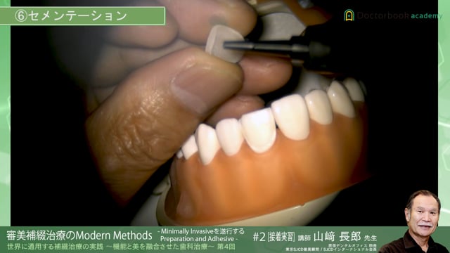 世界に通用する補綴治療の実践 ～機能と美を融合させた歯科治療～ 第4