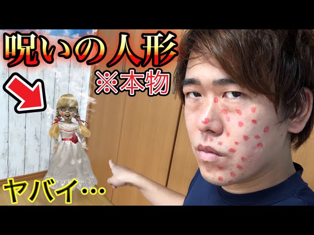 Viewer discretion advised] Something terrifying happened when a