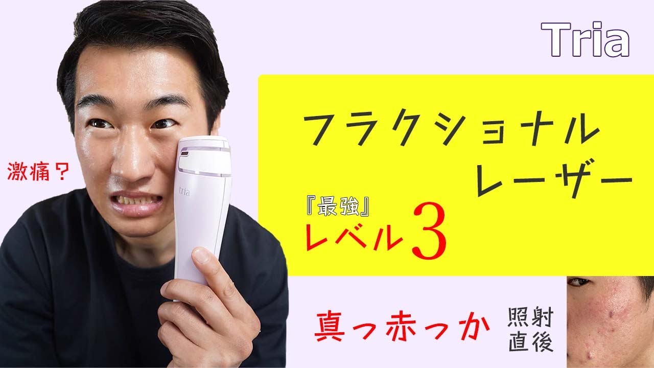 トリア スキンエイジングケアレーザーレベル3(MAX)で顔面をキレイにし