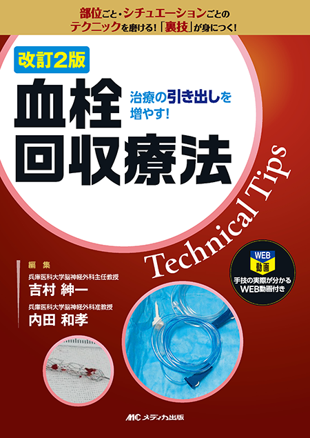 m3電子書籍 | dAVF・AVM（硬膜動静脈瘻・脳動静脈奇形）のすべて