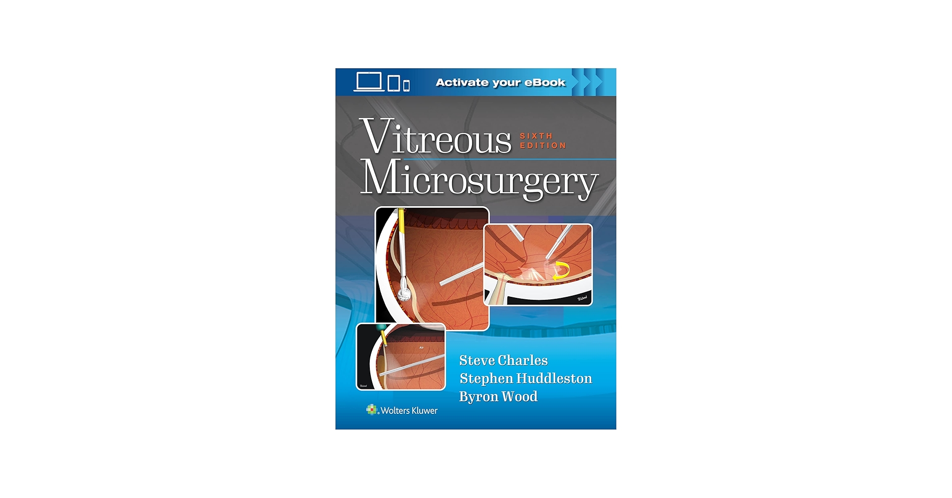 Vitreous Microsurgery: 9781975168353: Medicine & Health Science