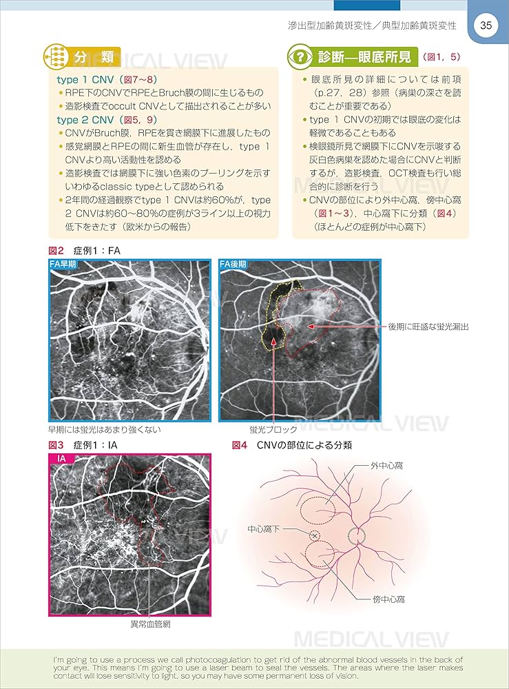 網膜診療クローズアップ 改訂第2版 | 柳 靖雄 |本 | 通販 | Amazon