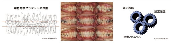 松風セミナー - セミナー詳細