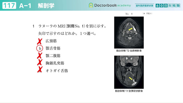 第117回歯科医師国家試験完全解説！ | Doctorbook academy (ドクター